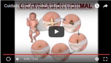 Todo Lo Que Debes Saber Sobre El Cordón Umbilical En Tú Bebé